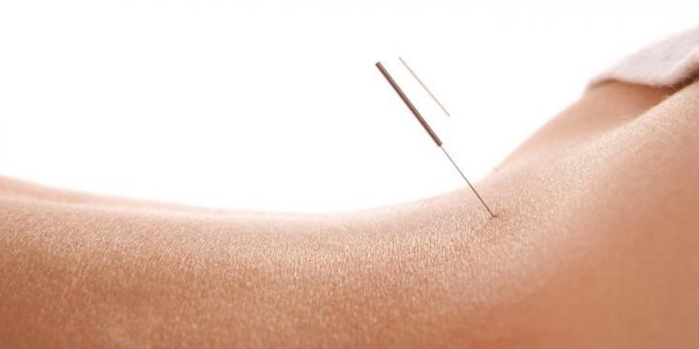 ACUPUNTURA OU FÁRMACOS? ABORDAGENS DIFERENTES QUE SE COMPLEMENTAM.